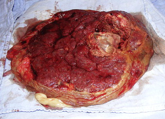 afterbirth.png